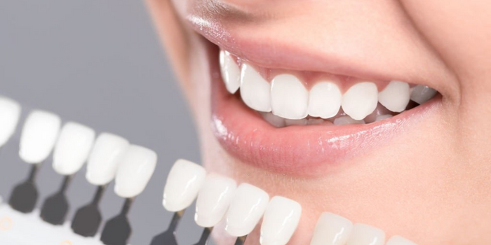 Zirkonyum Kaplama Tedavisi Sonrası Dişlere Bakım Nasıl Yapılmalıdır? 