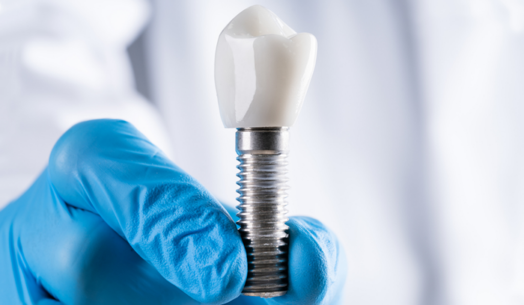 dental-implant